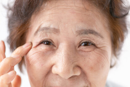 加齢によるもの